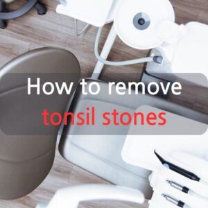 How to remove tonsil stones