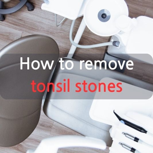 Tonsilloliths: Your Guide to a Ton-Free Mouth