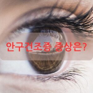 안구건조증 증상