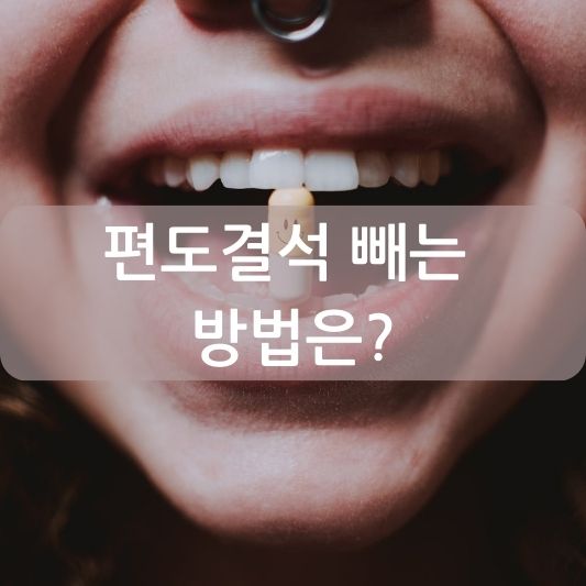 편도결석 빼는 방법과 예방 방법 알아보기!