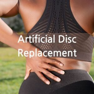 Artificial disc Replacement