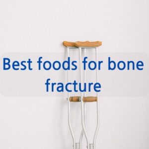 Best foods for bone fracture