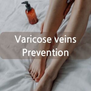 Varicose veins 