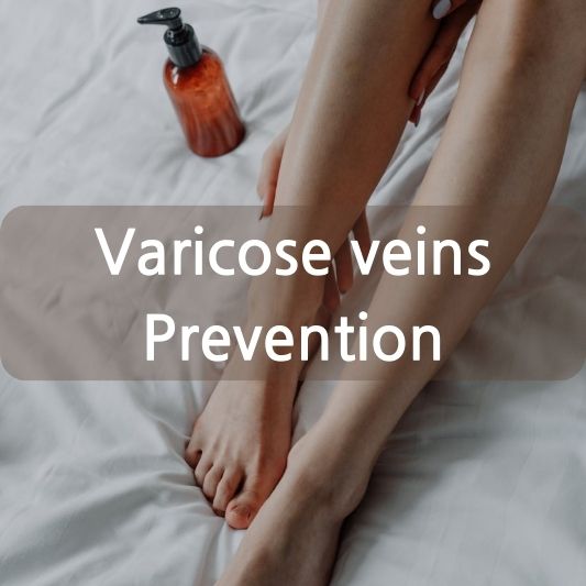 Varicose veins: Causes, symptoms, and treatment.