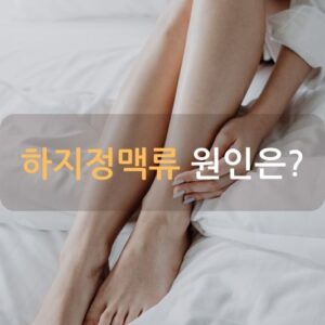 하지정맥류 