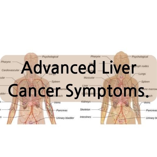 Navigating Advanced Liver Cancer Symptoms with Awareness and Hope