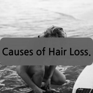 Causes of Hair Loss