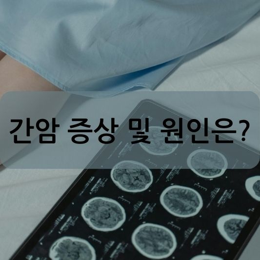 간암 증상 및 원인, 꼭 알아야 할 모든 것