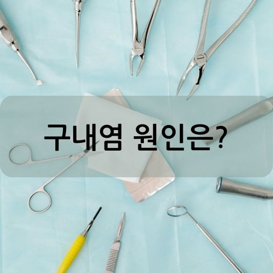 구내염, 원인과 증상, 예방 방법