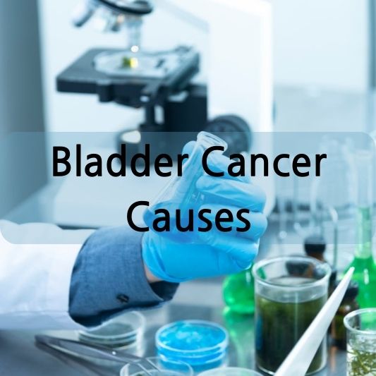 Bladder Cancer Causes