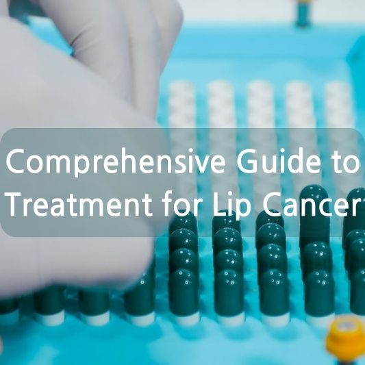 Comprehensive Guide to Treatment for Lip Cancer