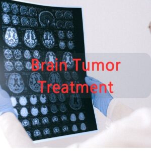 Brain Tumor Treatment