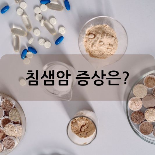 침샘암 증상 : 종류,치료 방법 알아보기!