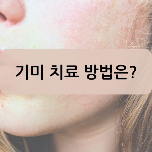 기미 치료 방법: 원인, 예방 방법 알아보기!