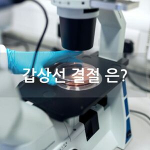 갑상선 결절