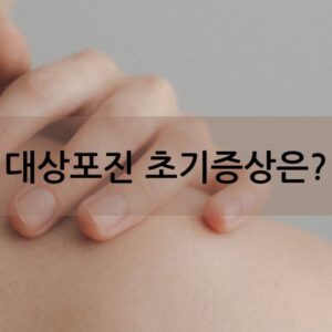 대상포진 초기 증상