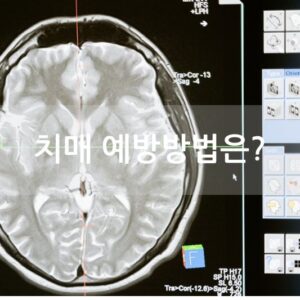 치매 예방방법