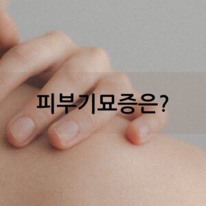 피부기묘증