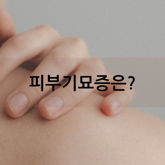 피부기묘증 증상: 긁으면 나타나는 붉은 자국 원인,치료 방법 알아보기!