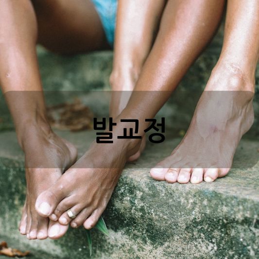 발교정의 모든 것: 아치를 살리고 통증을 예방하자!