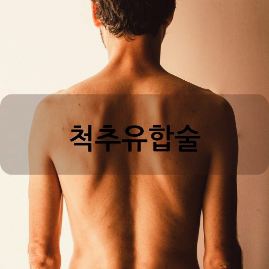 척추유합술 이해하기: 수술 전후 알아야 할 필수 정보 알아보기!