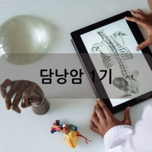 담낭암 1기