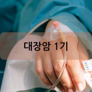 대장암 1기