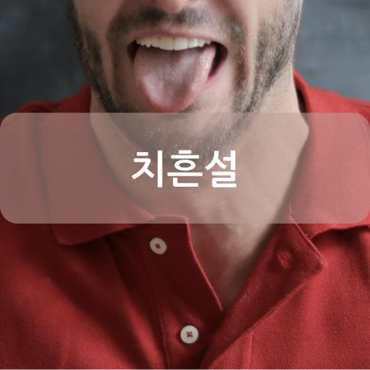 치흔설: 원인, 증상,관리 방법 알아보기!