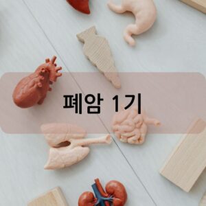 폐암 1기