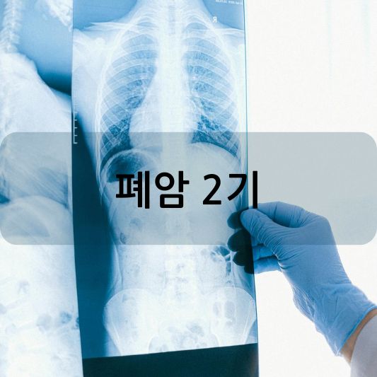 폐암 2기: 증상, 치료 및 생존율 알아보기!