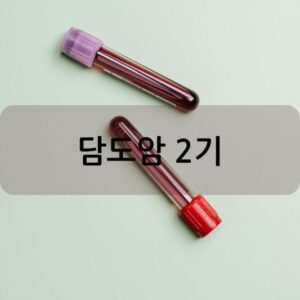 담도암 2기