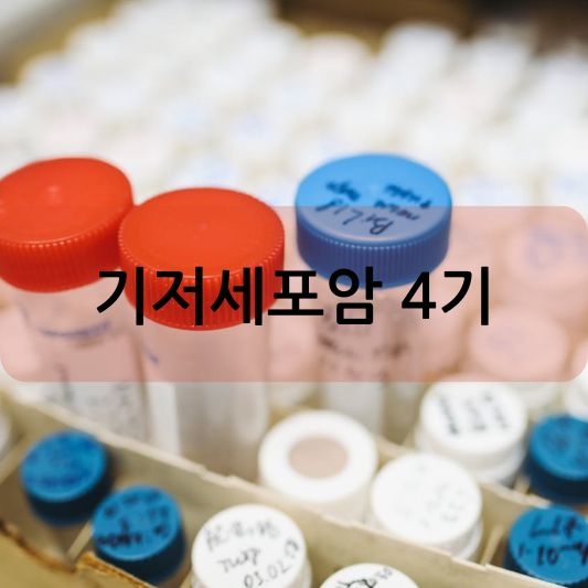 기저세포암 4기: 증상 진단 치료 방법 알아보기!