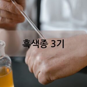 흑색종 3기