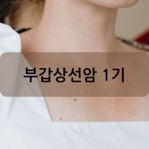 부갑상선암 1기