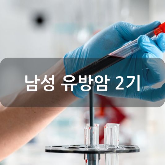 남성 유방암 2기: 원인, 증상, 치료 방법 알아보기!