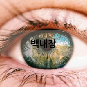 백내장