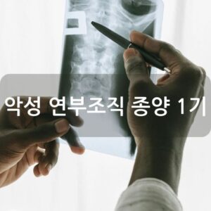 악성 연부조직 종양 1기