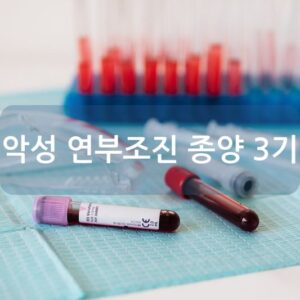 악성 연부조진 종양 3기