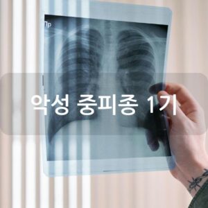 악성 중피종 1기
