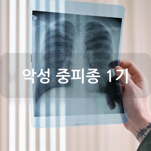 악성 중피종 1기: 원인, 증상, 치료 방법 알아보기!
