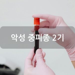 악성 중피종 2기