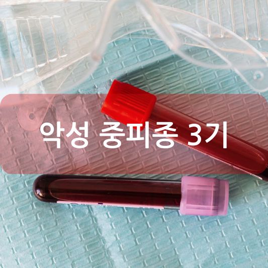 악성 중피종 3기: 원인, 증상, 치료 방법 알아보기!