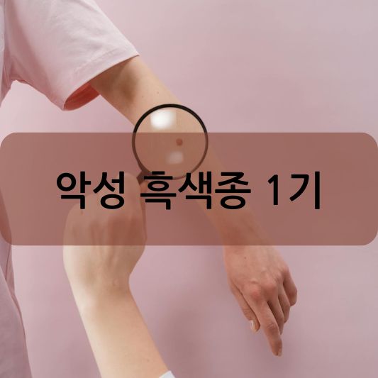 악성 흑색종 1기: 원인, 증상, 치료 방법 알아보기!