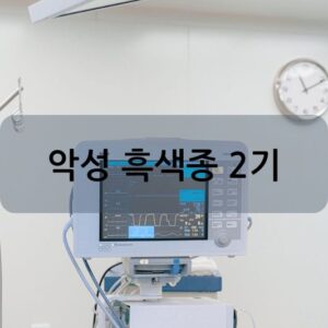 악성 흑색종 2기