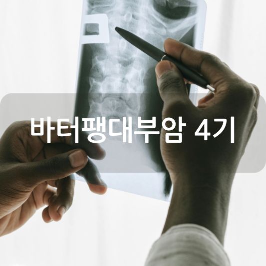 바터팽대부암 4기: 원인, 증상, 치료 방법 알아보기!