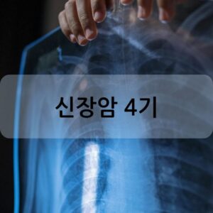 신장암 4기