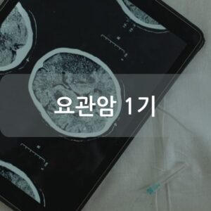 요관암 1기