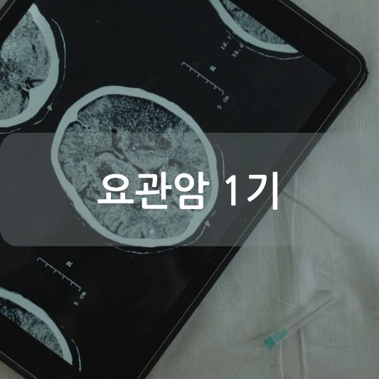 요관암 1기: 원인, 증상, 치료 방법 알아보기!