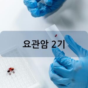 요관암 2기