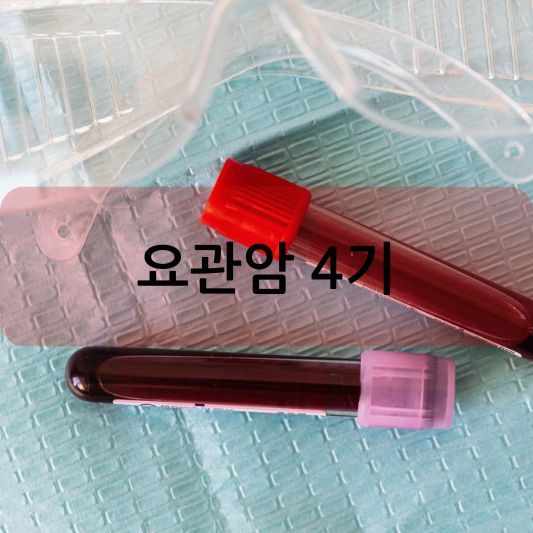 요관암 4기: 원인, 증상, 치료 방법 알아보기!